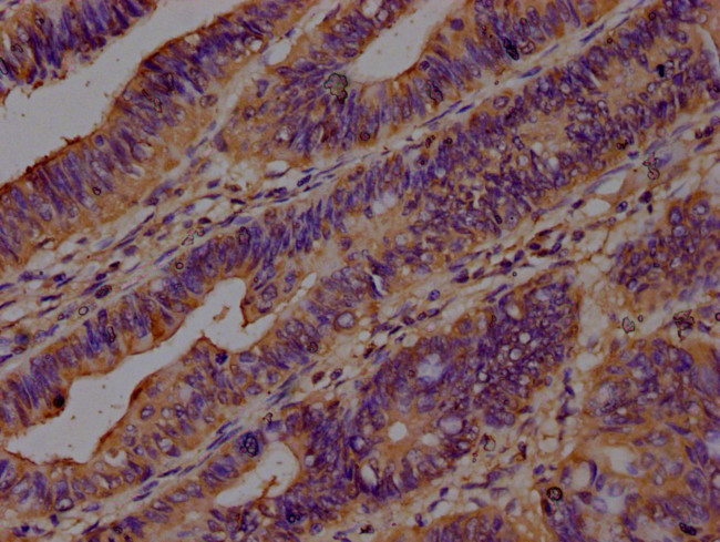 CAP1 Antibody in Immunohistochemistry (Paraffin) (IHC (P))