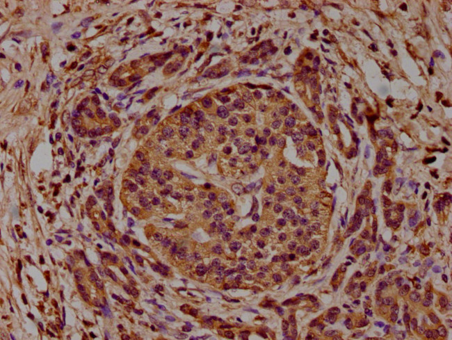 CAP1 Antibody in Immunohistochemistry (Paraffin) (IHC (P))