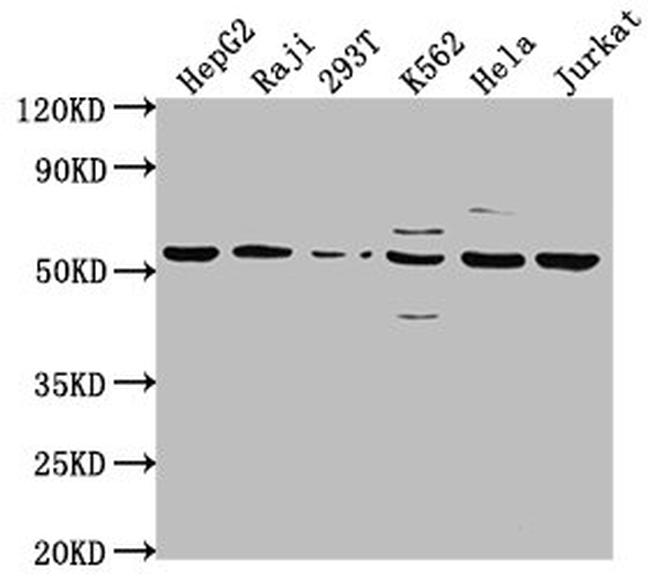 CAP1 Antibody in Western Blot (WB)