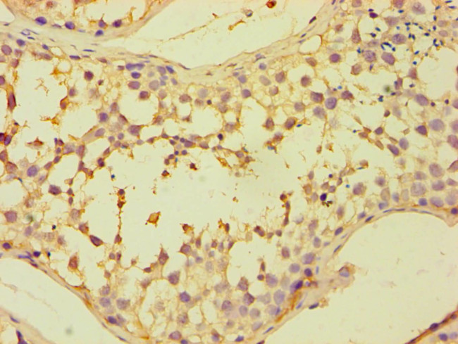 CAPZB Antibody in Immunohistochemistry (Paraffin) (IHC (P))