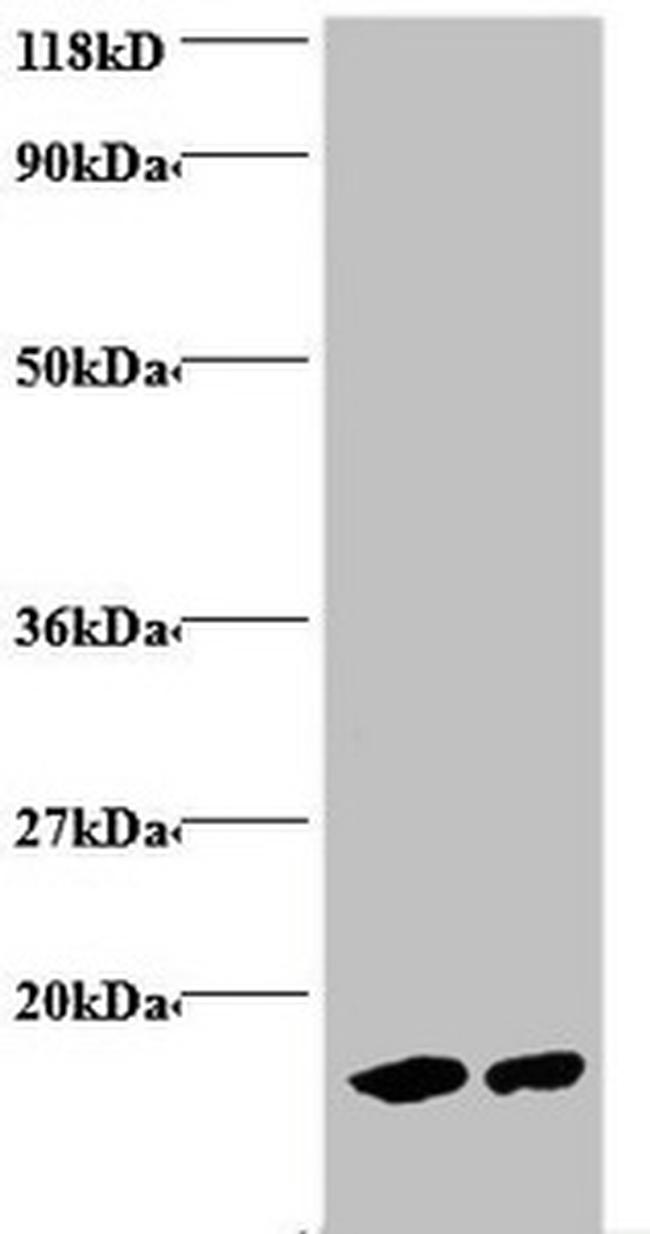 Hemoglobin Antibody in Western Blot (WB)