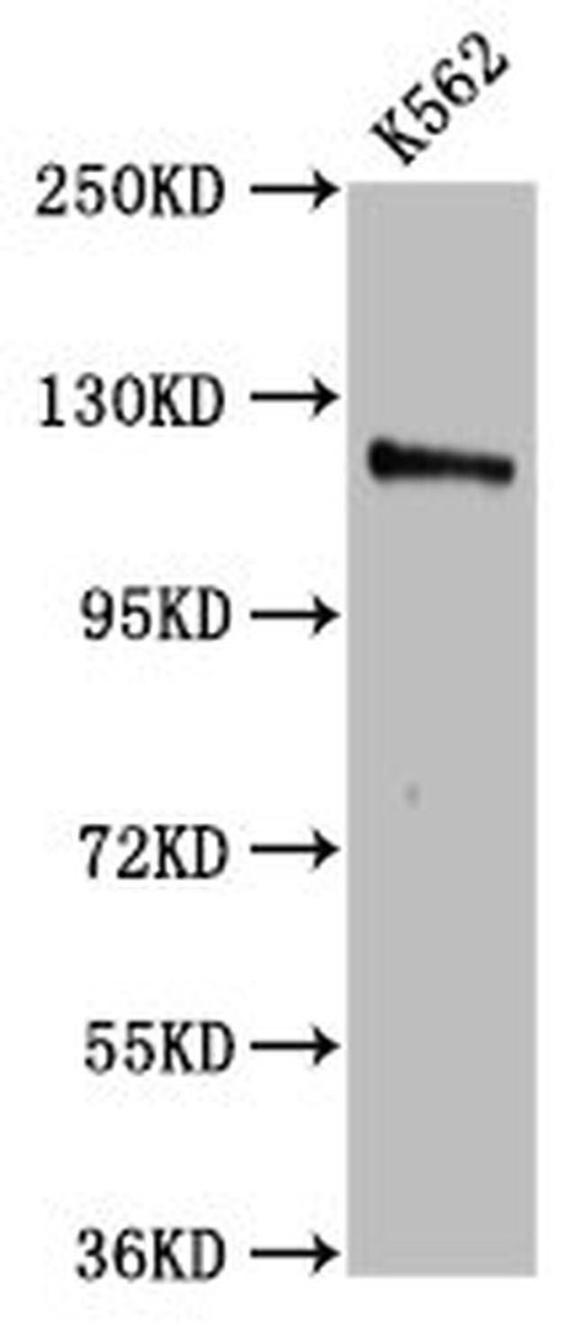 CENPJ Antibody in Western Blot (WB)