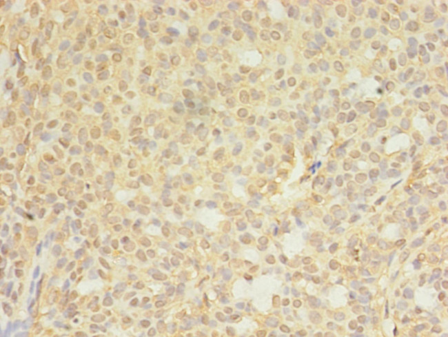 CTPS Antibody in Immunohistochemistry (Paraffin) (IHC (P))