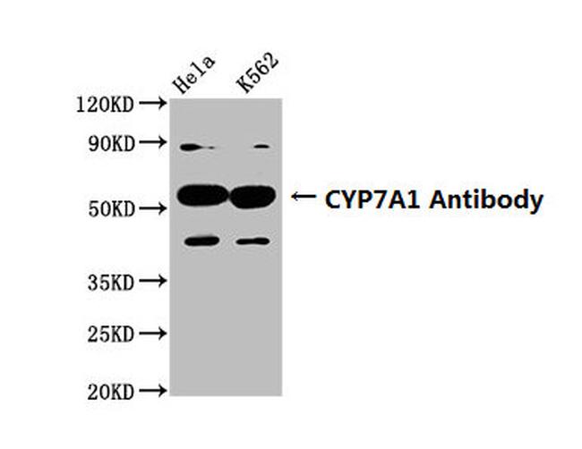CYP7A1 Antibody in Western Blot (WB)