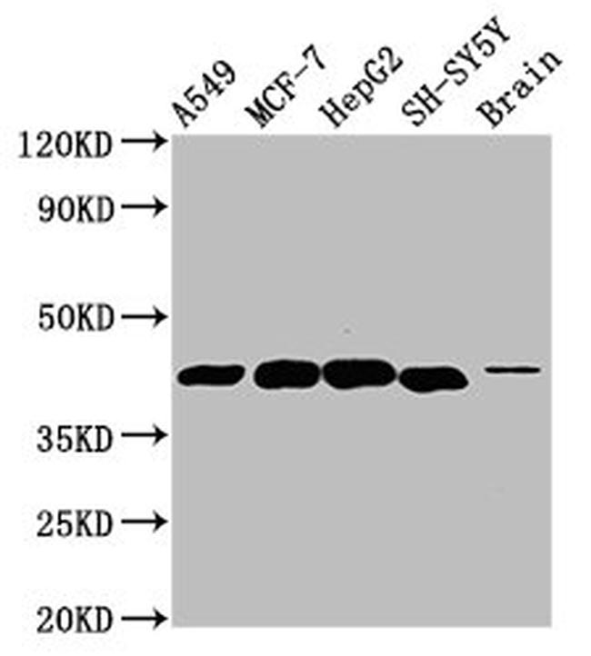 DLK1 Antibody in Western Blot (WB)