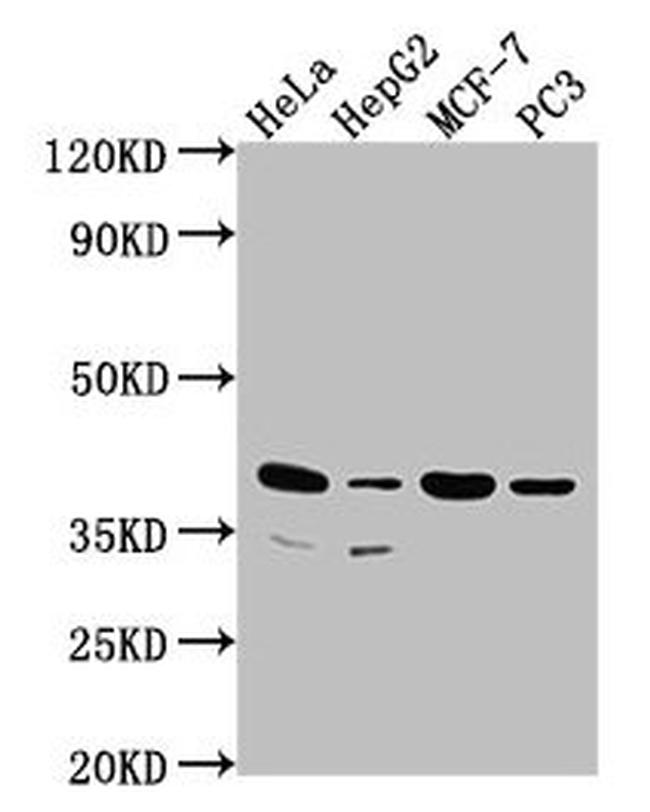 DUSP11 Antibody in Western Blot (WB)