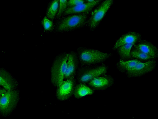 RPS5 Antibody in Immunocytochemistry (ICC/IF)