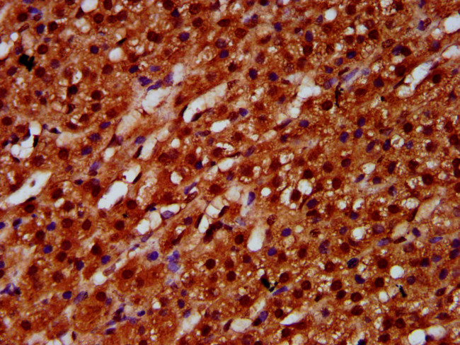 ETV5 Antibody in Immunohistochemistry (Paraffin) (IHC (P))