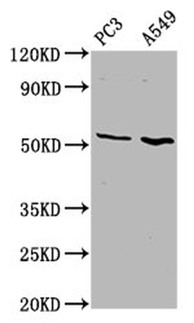 ETV5 Antibody in Western Blot (WB)