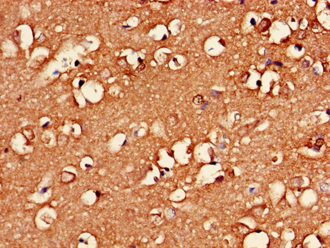 EXO1 Antibody in Immunohistochemistry (Paraffin) (IHC (P))