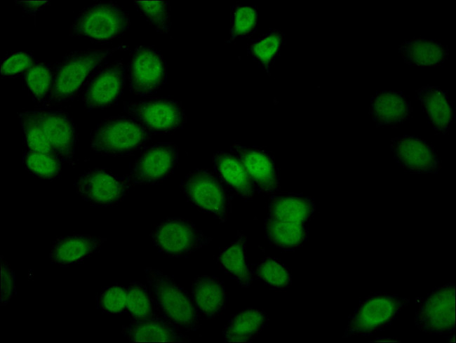 FLI1 Antibody in Immunocytochemistry (ICC/IF)