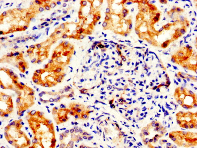 FLI1 Antibody in Immunohistochemistry (Paraffin) (IHC (P))