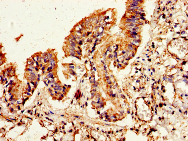 FLI1 Antibody in Immunohistochemistry (Paraffin) (IHC (P))