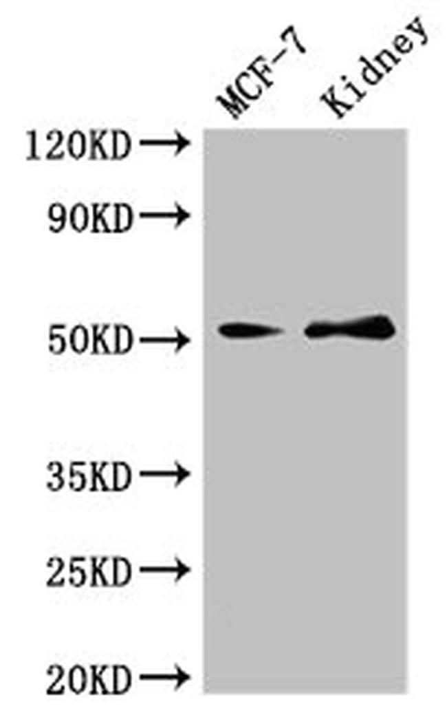 GFR alpha-1 Antibody in Western Blot (WB)