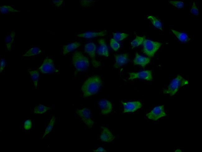 GLP1R Antibody in Immunocytochemistry (ICC/IF)