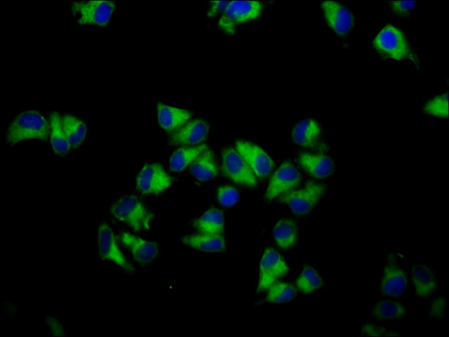 GNA12 Antibody in Immunocytochemistry (ICC/IF)