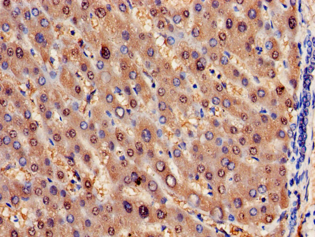 HPD Antibody in Immunohistochemistry (Paraffin) (IHC (P))