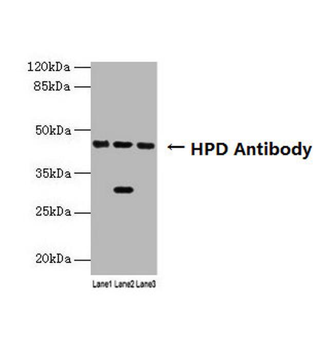 HPD Antibody in Western Blot (WB)