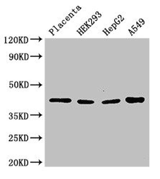 HSD3B1 Antibody in Western Blot (WB)