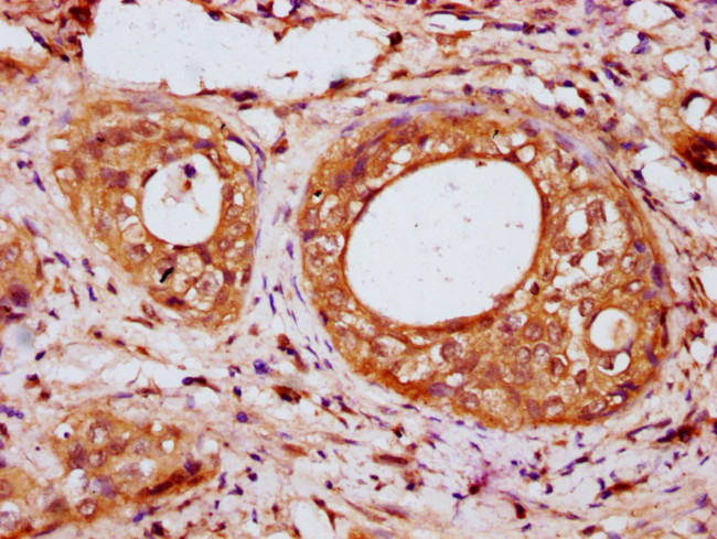 IRX6 Antibody in Immunohistochemistry (Paraffin) (IHC (P))