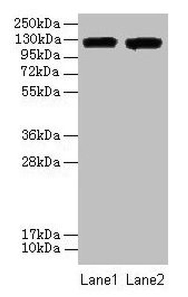 CD11a Antibody in Western Blot (WB)