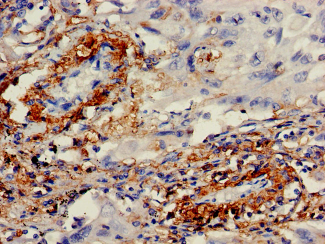 IMPDH2 Antibody in Immunohistochemistry (Paraffin) (IHC (P))