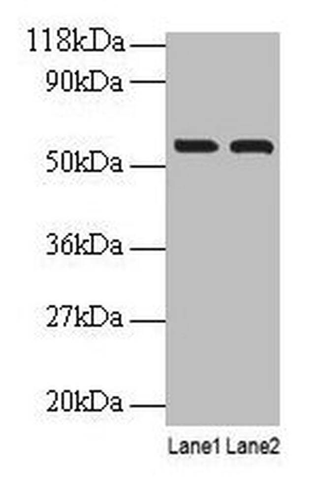 IMPDH2 Antibody in Western Blot (WB)