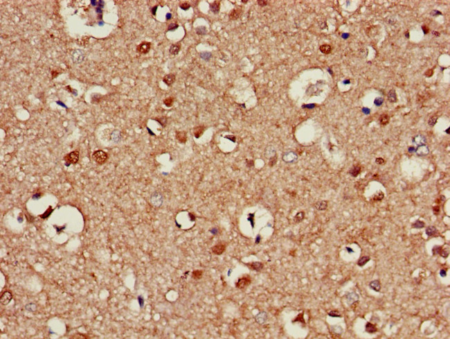 ATG13 Antibody in Immunohistochemistry (Paraffin) (IHC (P))