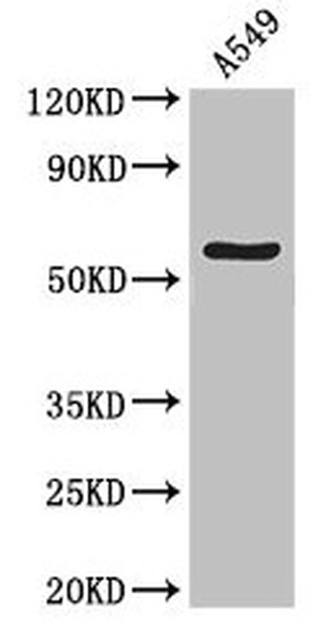 ATG13 Antibody in Western Blot (WB)