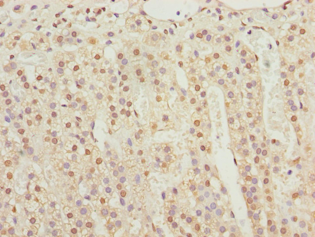 KPNA6 Antibody in Immunohistochemistry (Paraffin) (IHC (P))