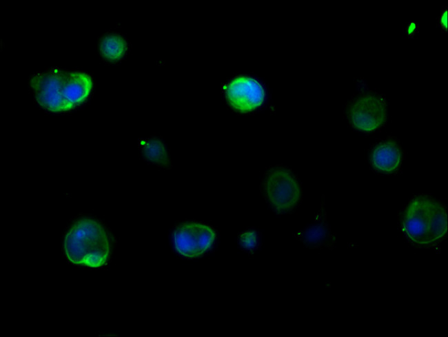 Cytokeratin 16 Antibody in Immunocytochemistry (ICC/IF)