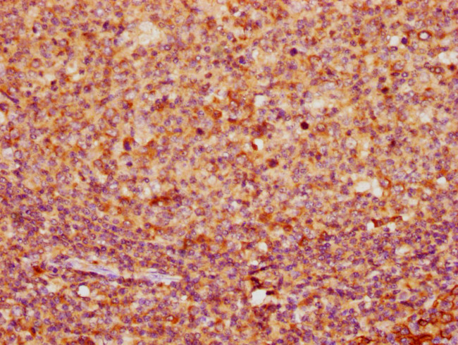 Cytokeratin 16 Antibody in Immunohistochemistry (Paraffin) (IHC (P))