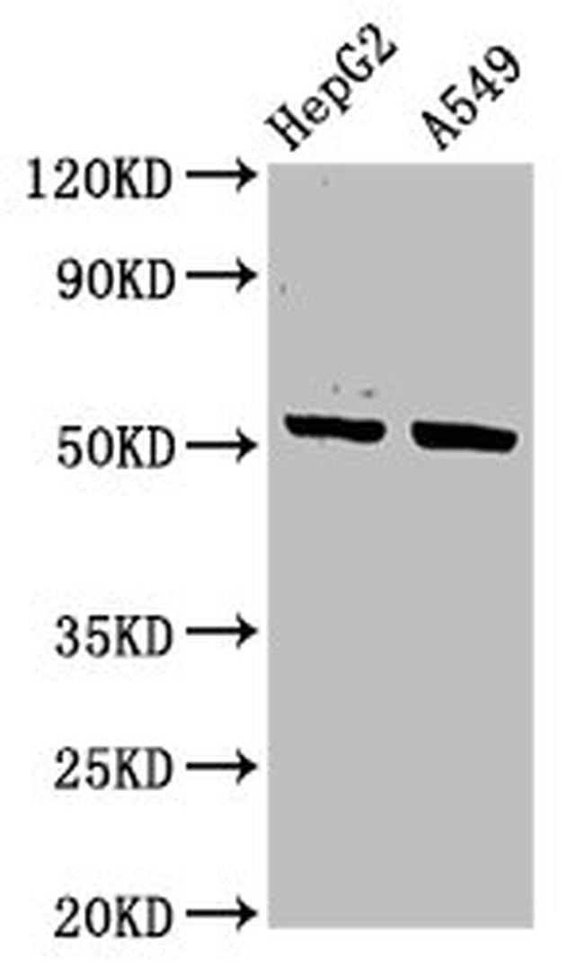 Cytokeratin 16 Antibody in Western Blot (WB)