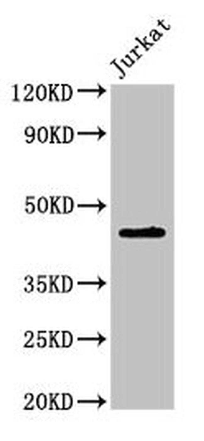 LPXN Antibody in Western Blot (WB)