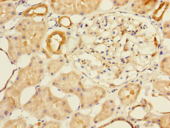 MTHFD2 Antibody in Immunohistochemistry (Paraffin) (IHC (P))