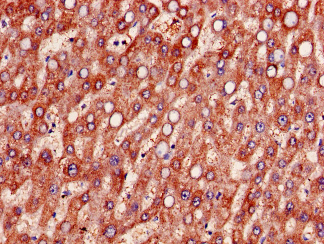 MTHFS Antibody in Immunohistochemistry (Paraffin) (IHC (P))