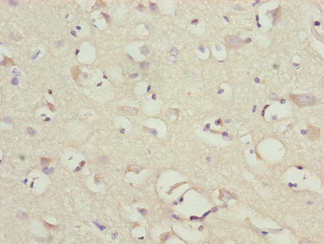 NDUFB10 Antibody in Immunohistochemistry (Paraffin) (IHC (P))