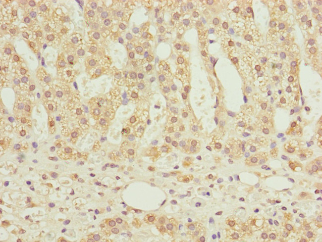 NDUFS6 Antibody in Immunohistochemistry (Paraffin) (IHC (P))