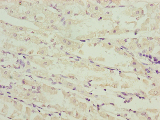 NDUFS6 Antibody in Immunohistochemistry (Paraffin) (IHC (P))