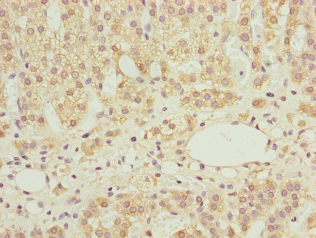 NDUFS6 Antibody in Immunohistochemistry (Paraffin) (IHC (P))