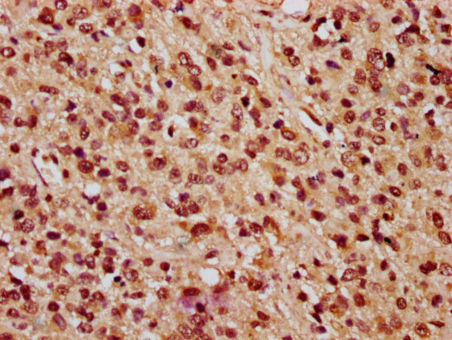 PARP3 Antibody in Immunohistochemistry (Paraffin) (IHC (P))