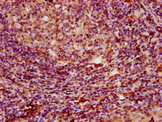 PARP3 Antibody in Immunohistochemistry (Paraffin) (IHC (P))