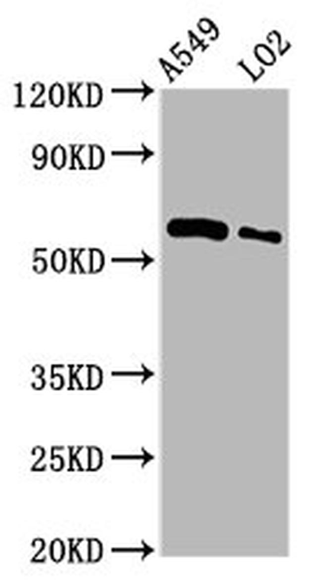 PARP3 Antibody in Western Blot (WB)