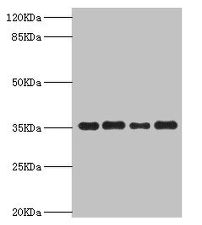 PDXK Antibody in Western Blot (WB)