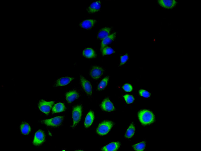 PEMT Antibody in Immunocytochemistry (ICC/IF)