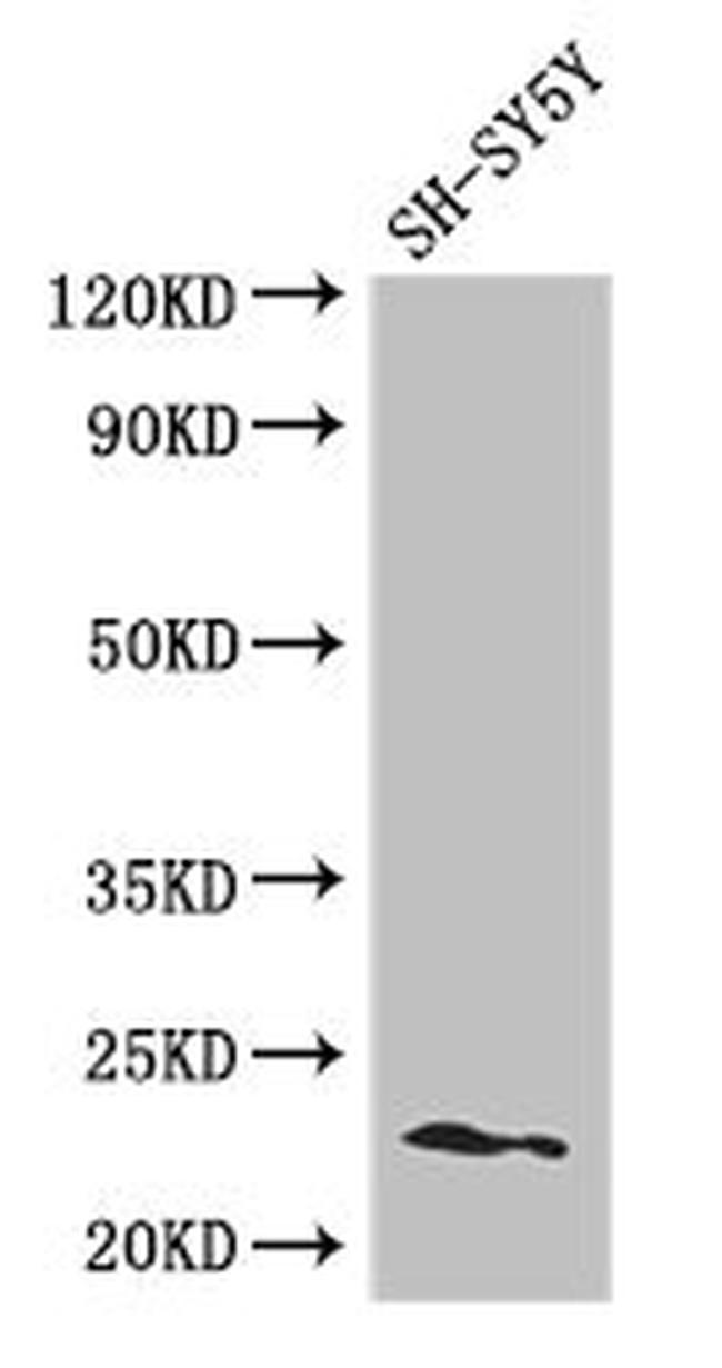 PEMT Antibody in Western Blot (WB)