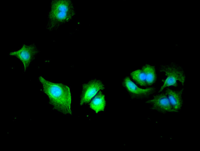 PLS3 Antibody in Immunocytochemistry (ICC/IF)