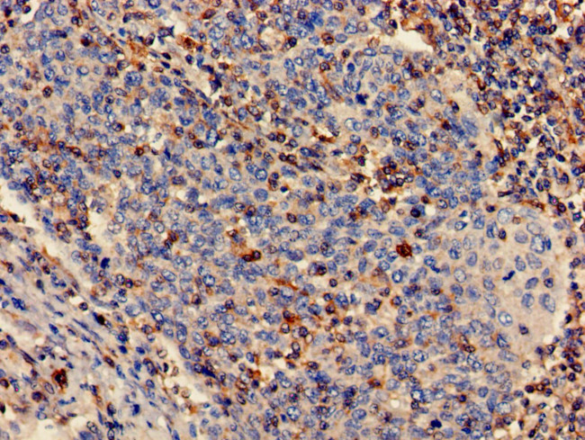 PLS3 Antibody in Immunohistochemistry (Paraffin) (IHC (P))