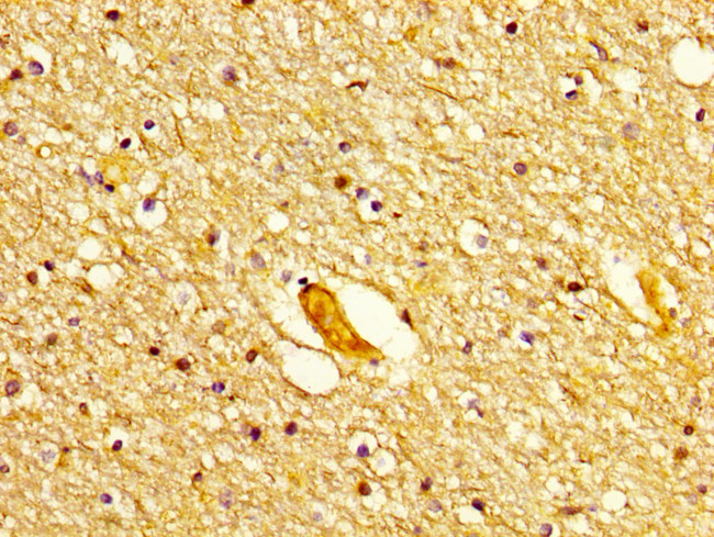 POLD1 Antibody in Immunohistochemistry (Paraffin) (IHC (P))