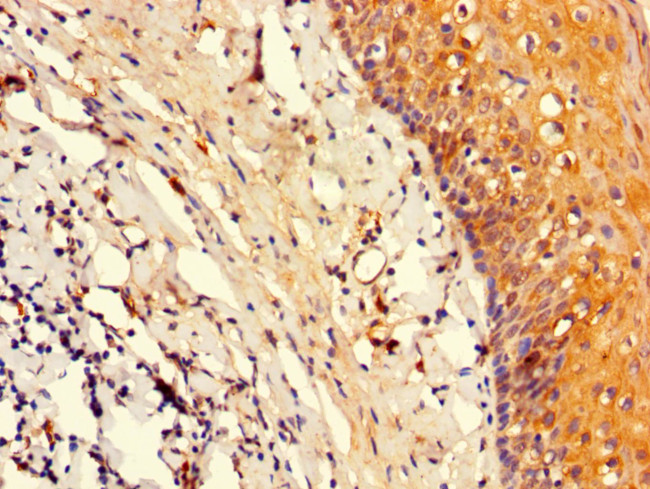 Oct-2 Antibody in Immunohistochemistry (Paraffin) (IHC (P))